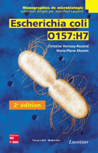 Escherichia coli 0157:H7
